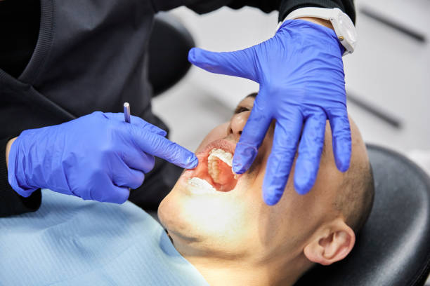 Best Root Canal Emergency Dentist  in Sunnyside, CA