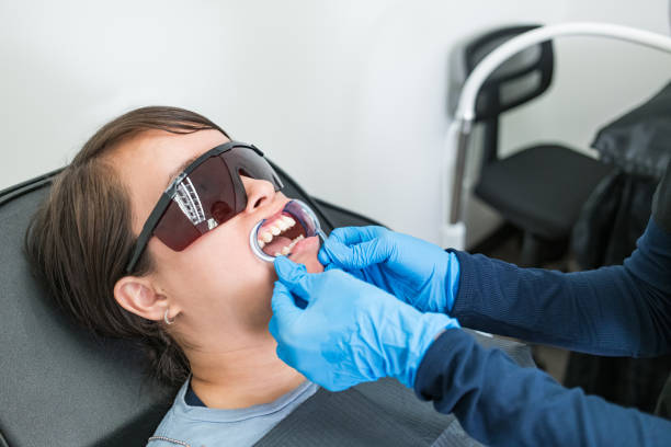 Best Chipped Tooth Repair Near Me  in Sunnyside, CA